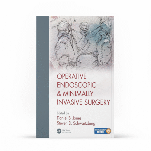 Operative Endoscopic and Minimally Invasive Surgery (English Edition)